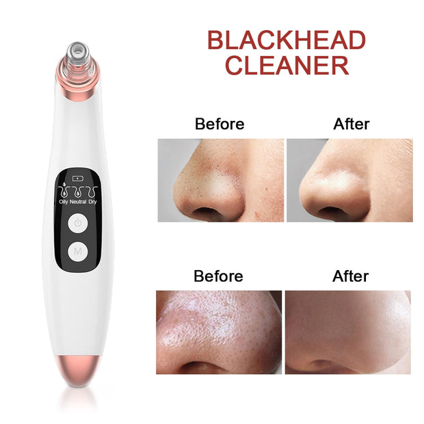 Ultrasonic Skin Scrubber & Pore Cleaner Blackhead Remover FREE GIFT w/ PURCHASE Nano Sprayer