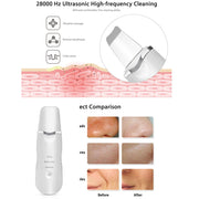 Ultrasonic Skin Scrubber & Pore Cleaner Blackhead Remover FREE GIFT w/ PURCHASE Nano Sprayer