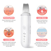 Ultrasonic Skin Scrubber + FREE Jade Roller